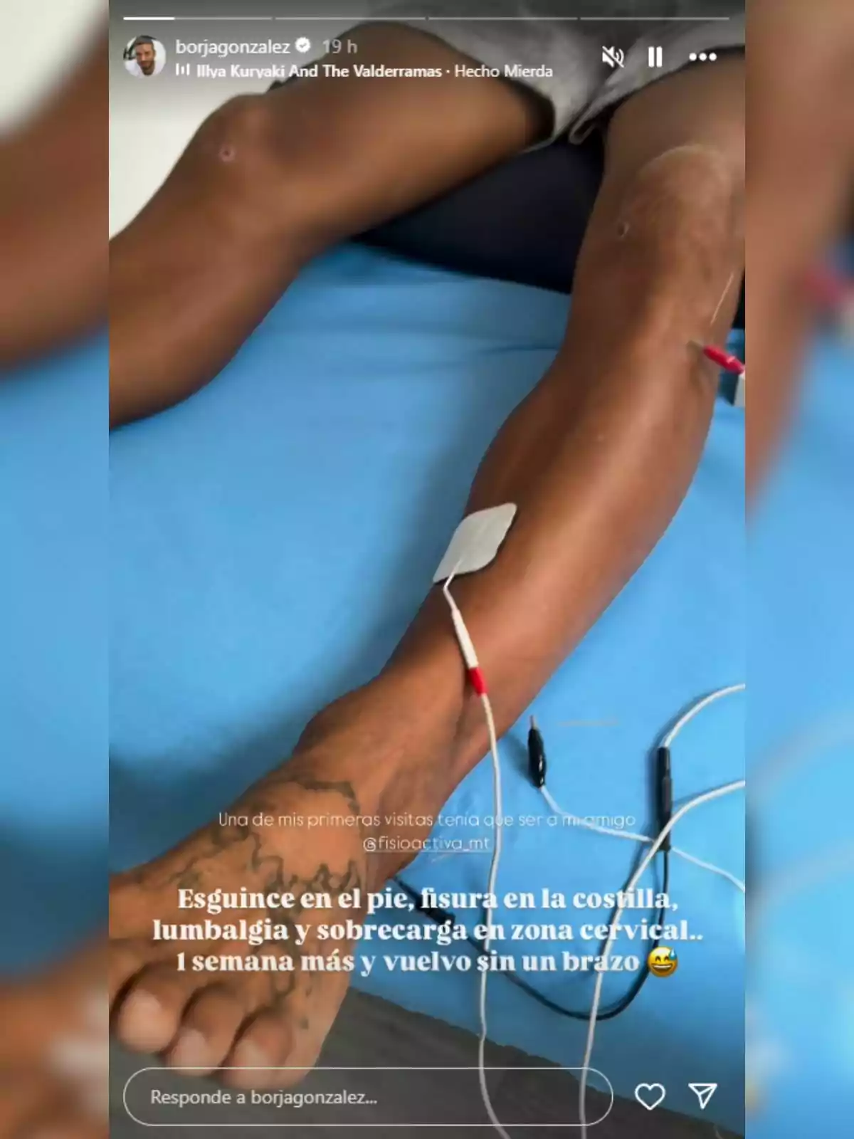 Borja González recostado en una camilla con electrodos en la pierna y cables conectados, mostrando una lesión y un mensaje sobre varias lesiones físicas.