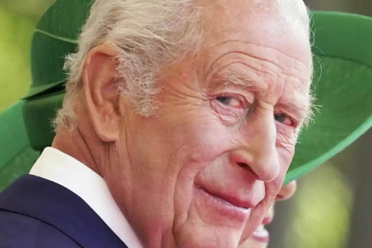 Close-up of Charles III with a hemorrhage in his eye, looking at the camera with a serious expression and a blurred background. Close-up of Charles III with a hemorrhage in his eye, looking at the camera with a serious expression and a blurred background.