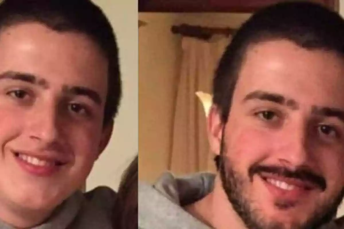 Dos fotos de un hombre joven, una con barba y otra sin barba.
