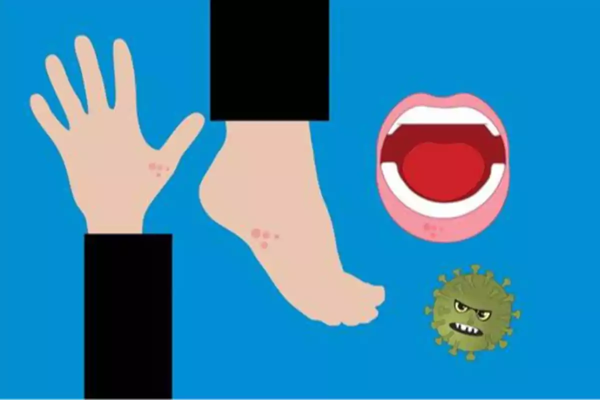 Ilustración de una mano, un pie, una boca abierta y un virus, con erupciones en la piel de la mano, el pie y alrededor de la boca.