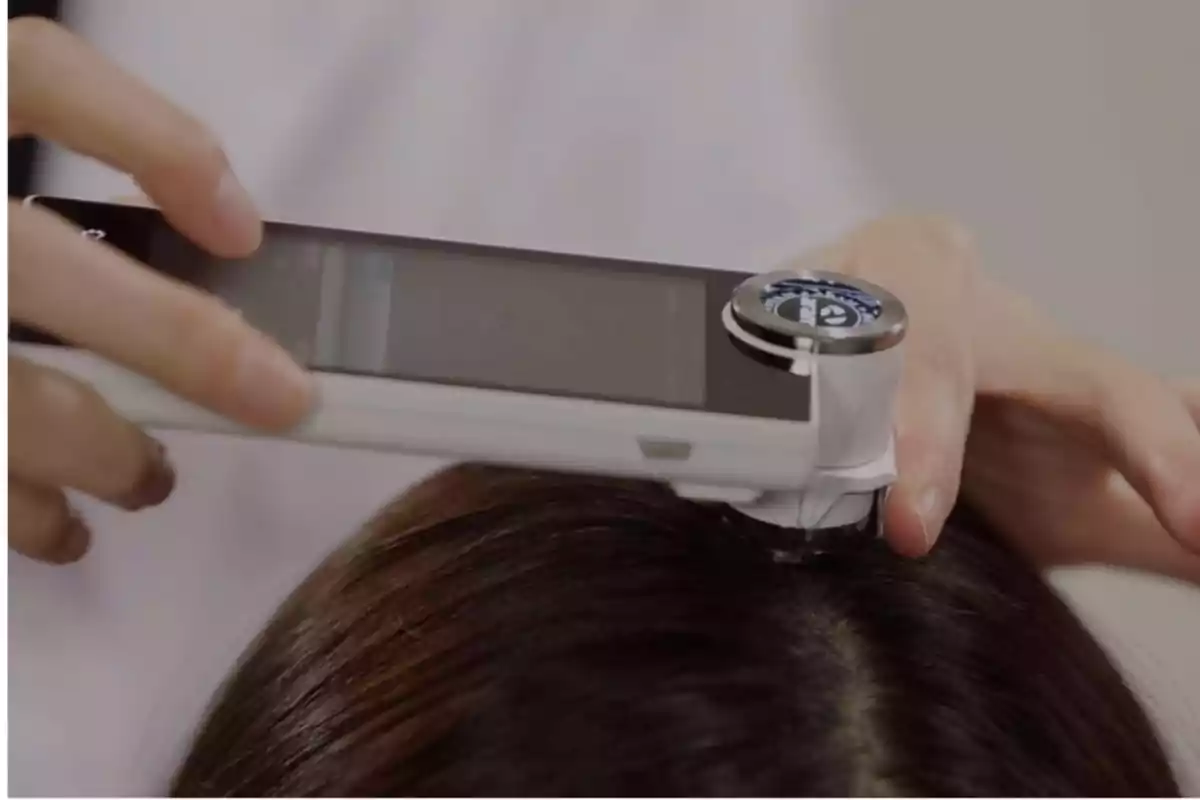 Un dispositivo médico se utiliza para examinar el cuero cabelludo de una persona.