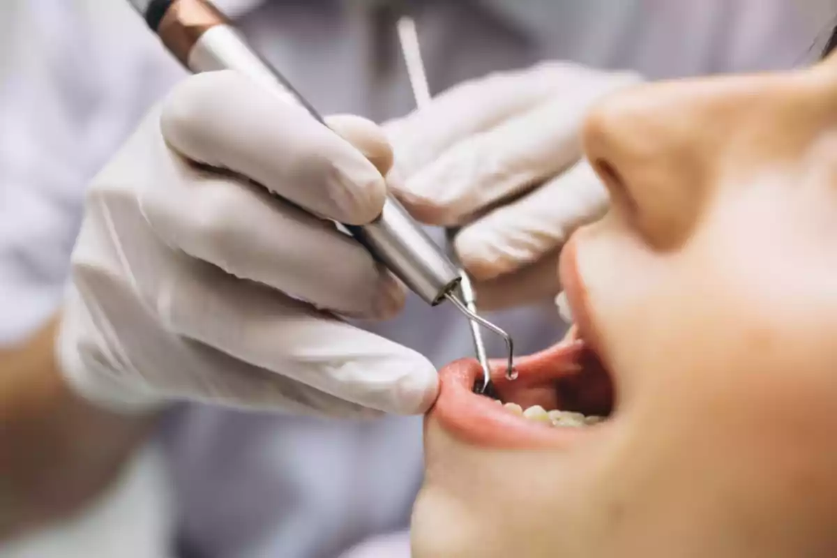 Dentista revisando los dientes de una persona con guantes y herramientas odontológicas