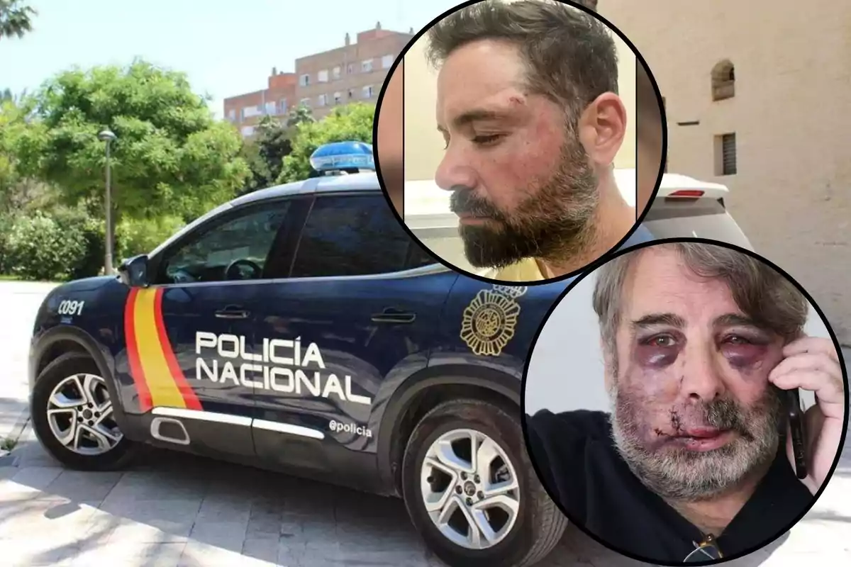 Un coche de la Policía Nacional y dos hombres con heridas en la cara.