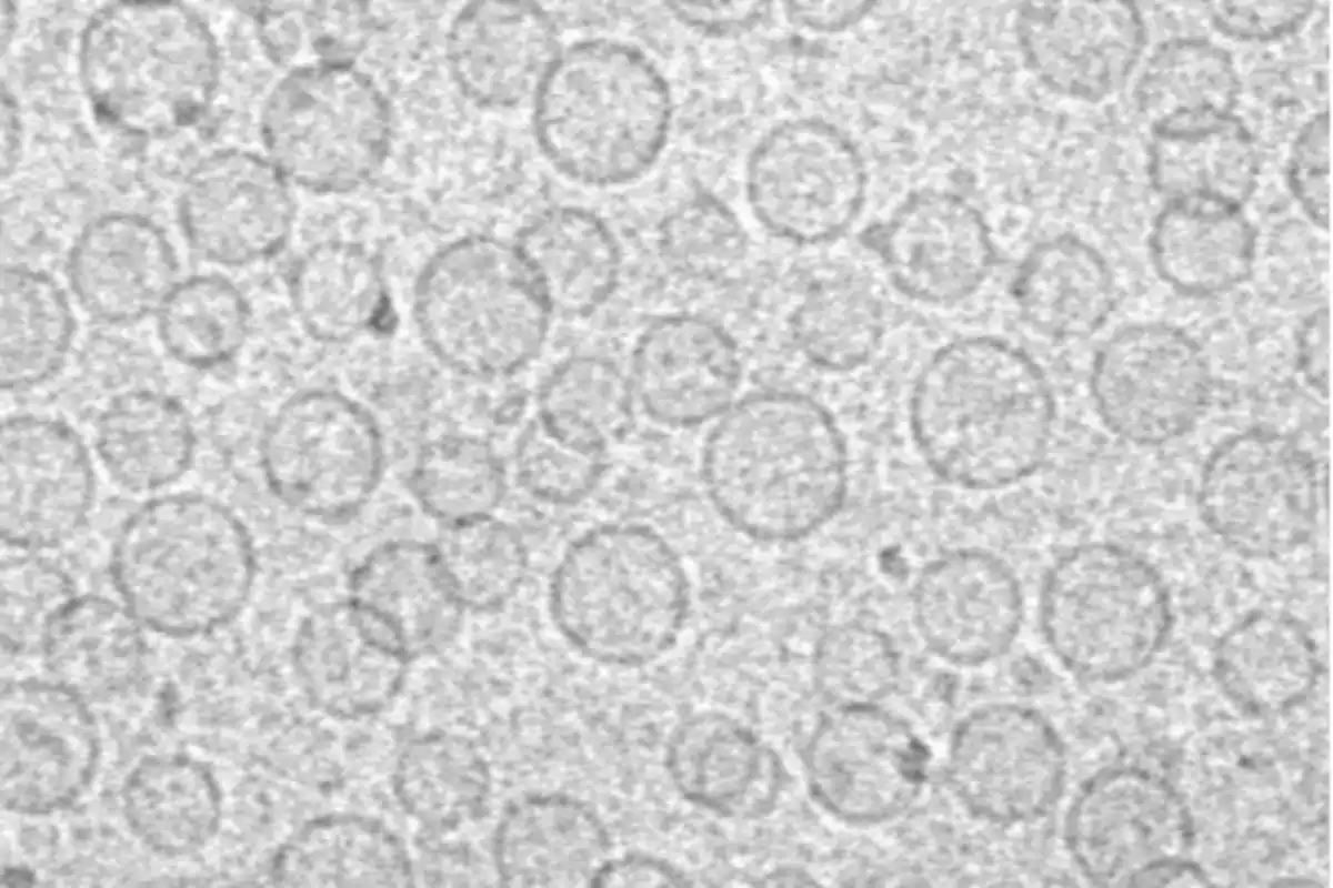 Imagen de un microscopio electrónico que muestra una agrupación de vesículas circulares.