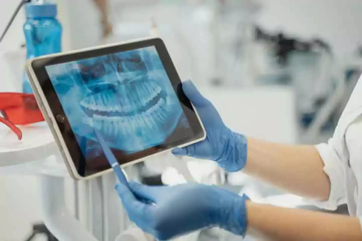 Persona con guantes azules sosteniendo una tableta que muestra una radiografía dental.