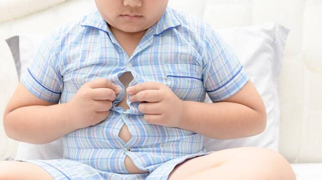 Obesidad infantil.