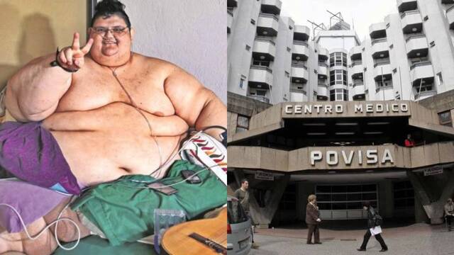 Persona con obesidad súper mórbida y el Hospital Ribera-Povisa de Vigo